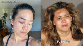 Former ‘Survivor’ contestant Michelle Yi attacked by homeless woman in Santa Monica, police say