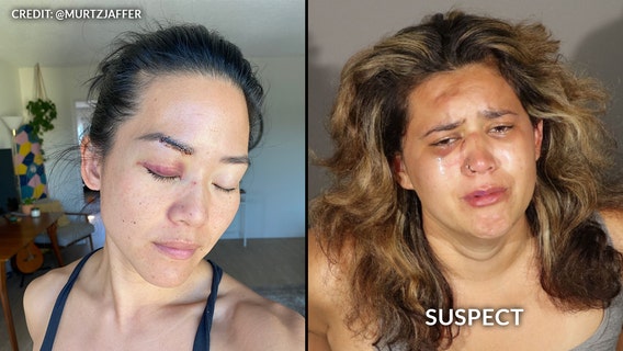 Former ‘Survivor’ contestant Michelle Yi attacked by homeless woman in Santa Monica, police say