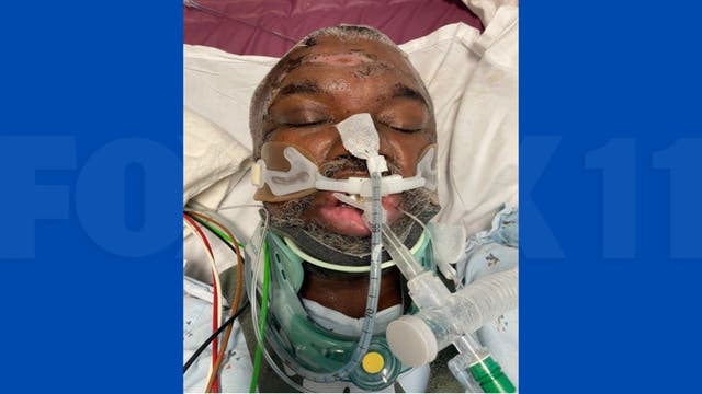 Hospital needs help identifying hit-and-run victim