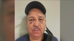 Boyle Heights community comes together to help restaurant owner attacked by homeless man