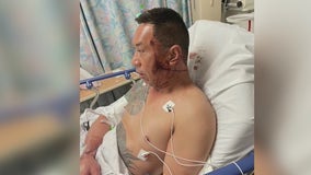 Man 'viciously attacked' by stranger in Chinatown stabbing