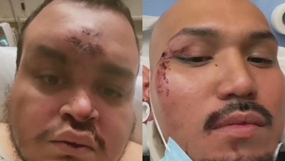 Attack after LGBTQ+ event in Pasadena being investigated as hate crime