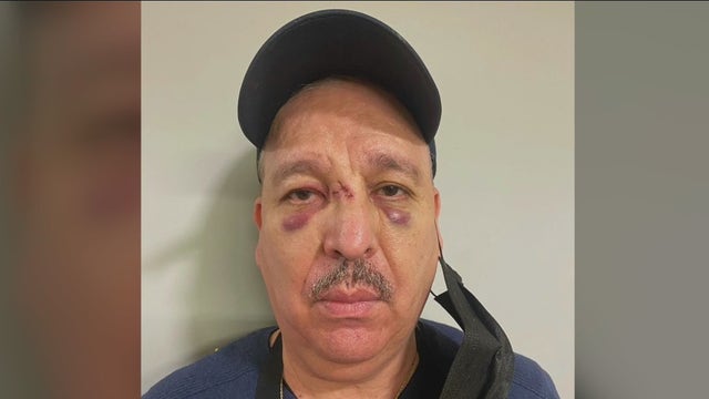 Boyle Heights community comes together to help restaurant owner attacked by homeless man