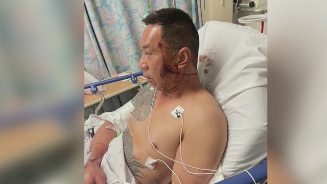 Man 'viciously attacked' by stranger in Chinatown stabbing