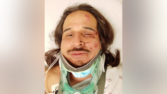 Dodgers sued: 3 lawsuits allege security assaulted fans