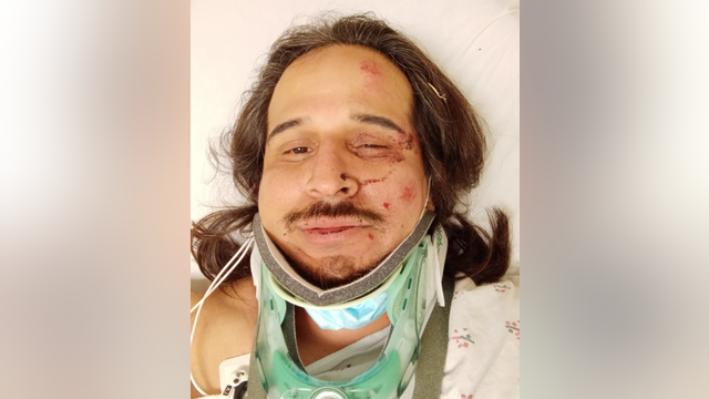 Dodgers sued: 3 lawsuits allege security assaulted fans