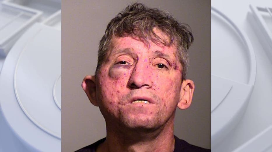 A suspected burglar suffered a beat down by a homeowner after the suspect was allegedly caught walking downstairs inside a Ventra County home. (PHOTO: Ventura County Sheriff's Office)