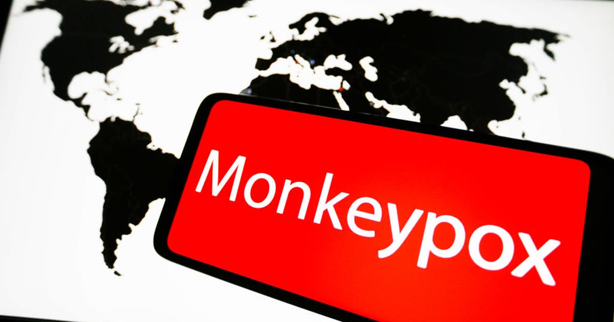 Orange County announces 1st case of monkeypox | FOX 11 Los Angeles
