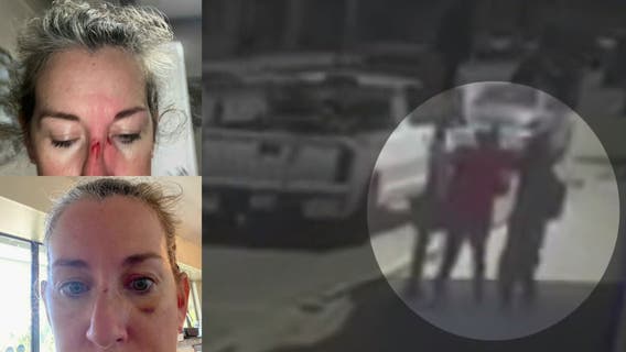 Doctor punched by homeless man outside a Pasadena hospital