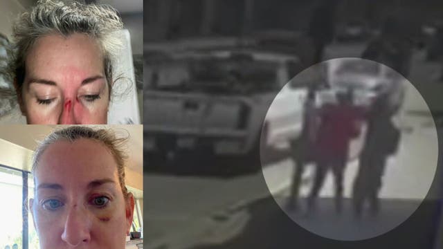 Doctor punched by homeless man outside a Pasadena hospital