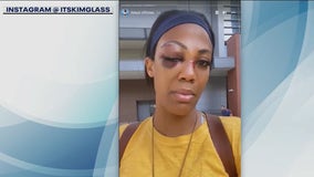 US Olympian Kim Glass allegedly attacked by homeless man in DTLA