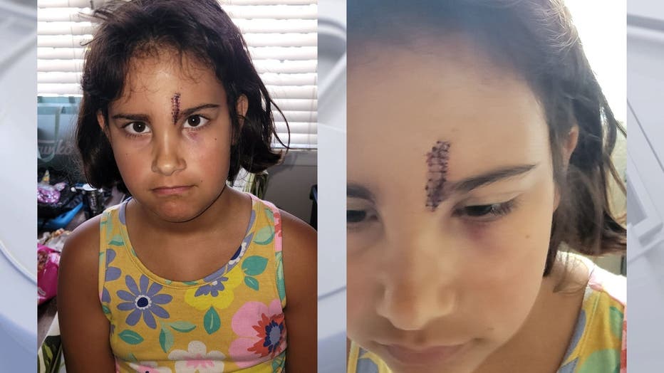 A girl needed stitches after a flying cell phone hit her face while she was on a roller coaster, her family tells FOX 11.