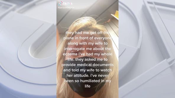 Woman allegedly kicked off Spirit Airlines flight after staff mistook eczema for monkeypox