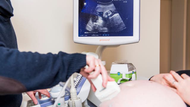 Fetuses can react to taste, smell while inside the womb, study says