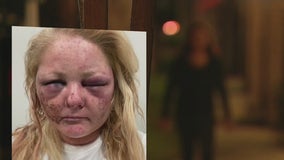 Torrance woman brutally beaten, raped by homeless man released from jail hours earlier