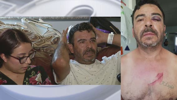 Dad attacked by 3 robbers on his way to work in South LA area