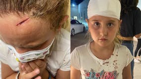 Falling cell phone hits girl in face while on Six Flags roller coaster; 2nd incident in 2 months
