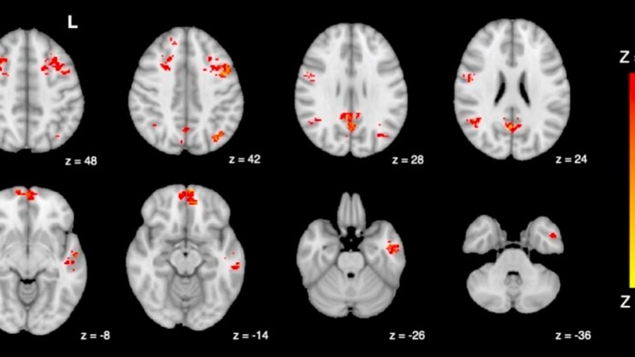 Studies show that sitting in traffic for just two hours can damage your brain