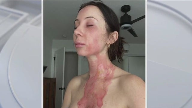 Man breaks into Koreatown home, throws boiling water on woman