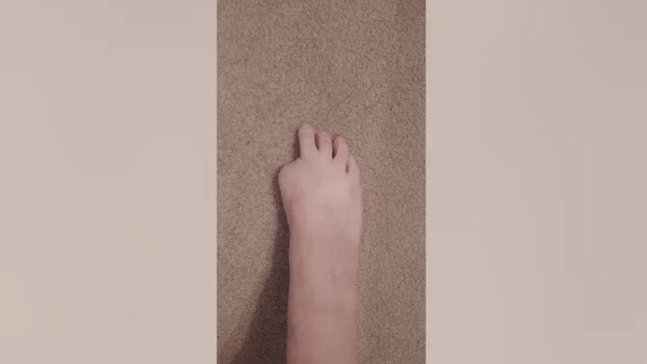 Georgia-woman-loses-toe-pedicure-VI.jpg
