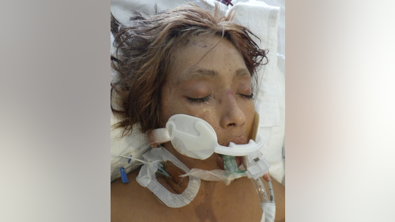 LA hospital seeks help identifying patient