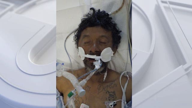 LA hospital seeks help identifying patient