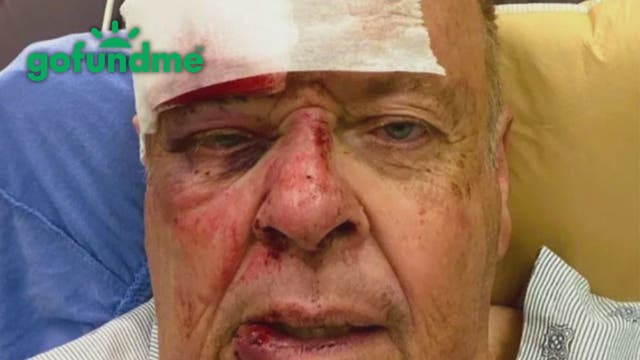 LAPD volunteer suffers fractured eye socket after horrific bee attack in Encino