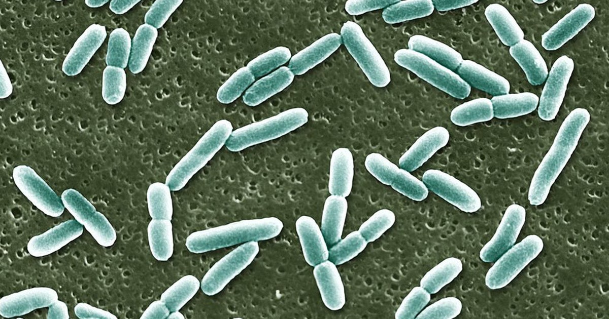 E. coli found in water in Jurupa Valley, parts of city under water ...