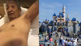 Grandpa, 81, attacked by Disneyland security dog: Lawsuit