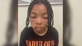 Girl attacked at McDonald's in front of crowd recording on cell phones – And almost no one helped