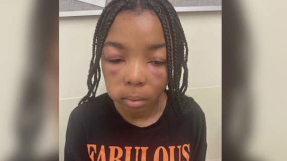 McDonald's sued by teen's mother after attack, claims restaurant failed to prevent or aid in child's beating