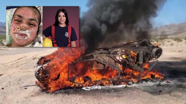 Pasadena teen pursues dream of becoming firefighter after suffering severe burns