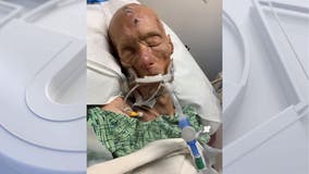 Santa Monica hospital asks for public's help identifying ICU patient