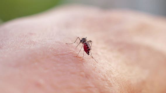 Pasadena reports case of Dengue virus