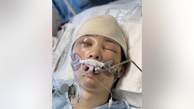 Los Angeles hospital seeks help identifying patient