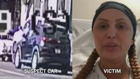 California mom says she was 'left to die' in hit-and-run crash
