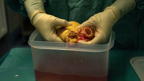 In Depth: Organ Transplants