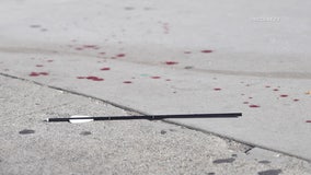 Man shot with arrow near Dodger Stadium