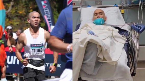 Amid leukemia battle, LA dad's bone marrow transplant hindered by visa delays