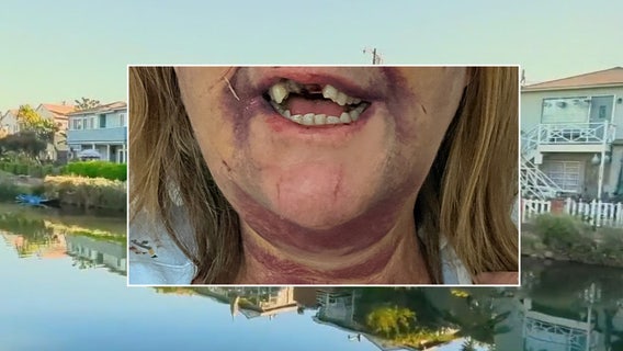 Venice Canals assaults: Suspect accused of brutally attacking 2 women caught in San Diego