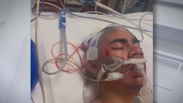 Teen brutally beaten by 3 people at Watts restaurant