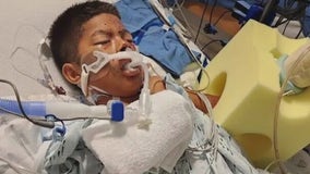 Improvised firework blows up in OC 10-year-old's hands