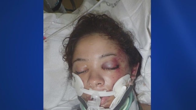 Los Angeles hospital seeks help identifying injured woman