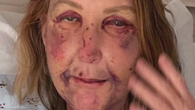 Venice Canals rape survivor seeks $5M in damages