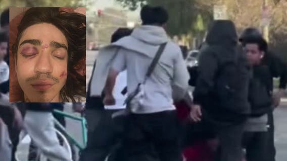 Young man survives angry teen mob attack in Los Angeles
