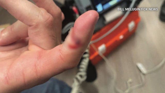 Russian national charged with biting ICE officer during DTLA arrest