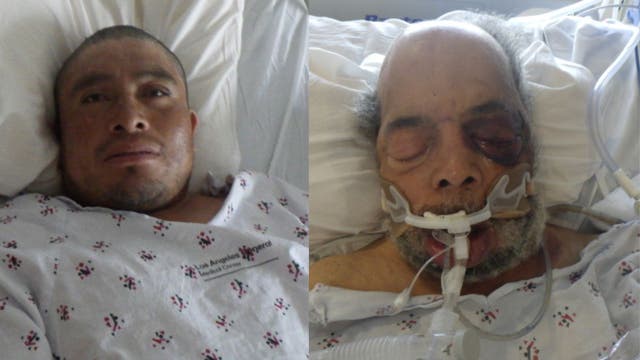 LA County hospital looking to identify two John Doe patients