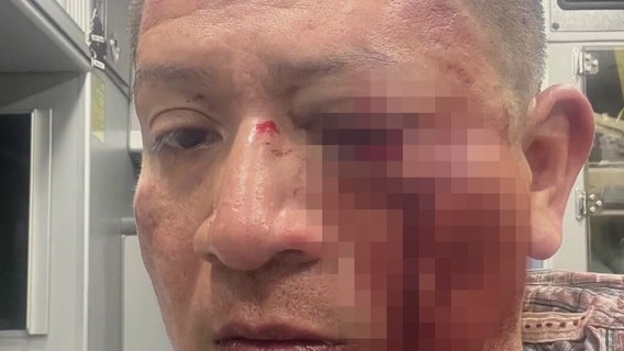 Inglewood gardener attacked in hate crime, police say