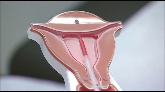 New guideline declares 'urgent need' for IUD insertion pain relief options
