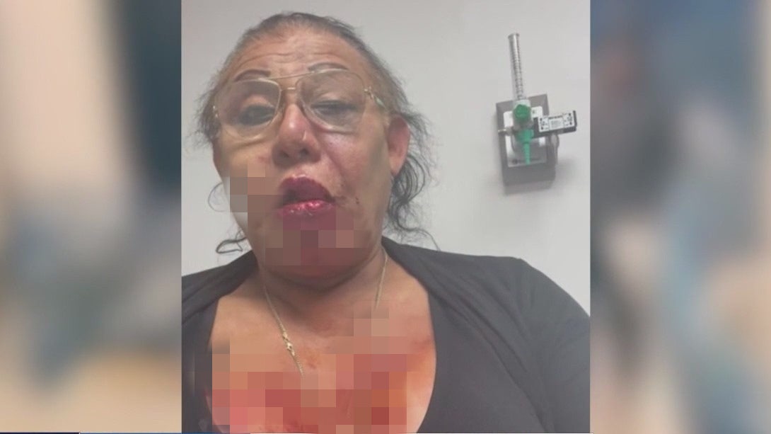 LA man charged with attempted murder, hate crimes in attacks on transgender store owner